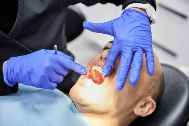 Best Emergency Tooth Extraction in Woodway, TX
